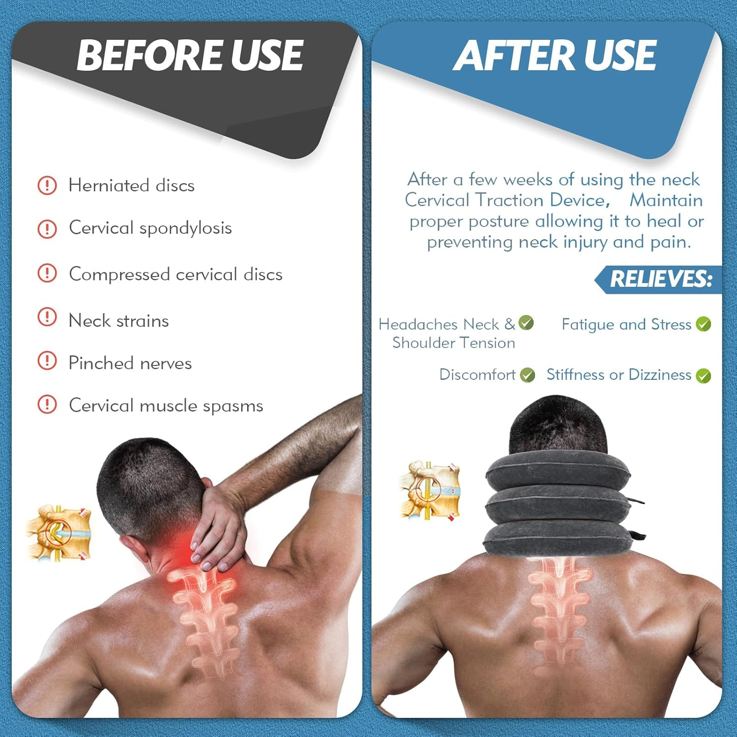Neck Stretcher Cervical Traction Device - Adjustable Inflatable Neck Brace for Neck Pain Relief & Decompression at Home (Dark Gray)