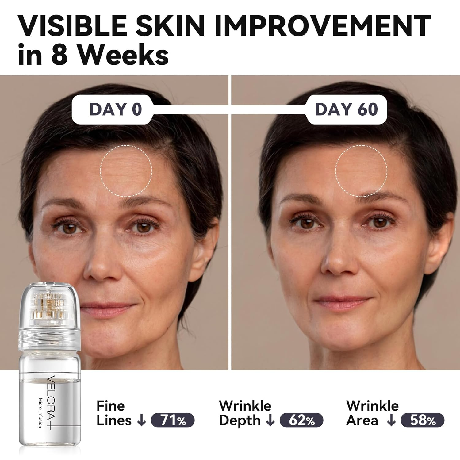 VELORA Micro Infusion Facial Kit